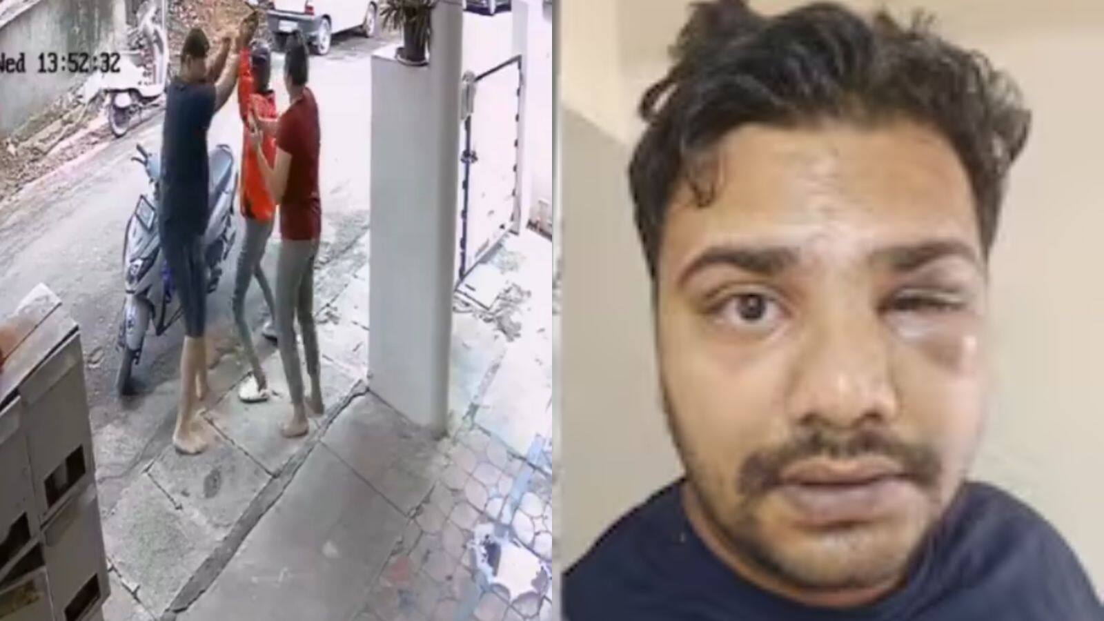National-बेंगलुरु में Zepto डिलीवरी बॉय ने ग्राहक पर किया हमला! सिर में आया फ्रैक्चर, कंपनी ने दिया जवाब – #INA National-बेंगलुरु में Zepto डिलीवरी बॉय ने ग्राहक पर किया हमला! सिर में आया फ्रैक्चर, कंपनी ने दिया जवाब – #INA