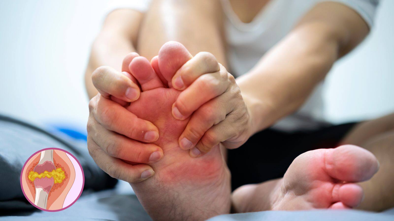 National-Uric Acid: बढ़ गया है आपका यूरिक एसिड? इन दालों से आज ही करें तौबा, यहां जानें सब कुछ – #INA National-Uric Acid: बढ़ गया है आपका यूरिक एसिड? इन दालों से आज ही करें तौबा, यहां जानें सब कुछ – #INA