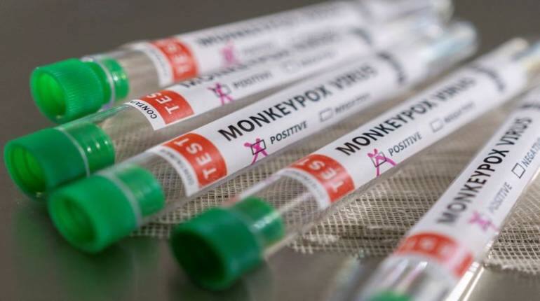 Monkeypox Updates: कोरोना के बीच मंकीपॉक्स ने बढ़ाई भारत की चिंता, तमिलनाडु और राजस्थान सहित इन राज्यों ने बढ़ाई चौकसी