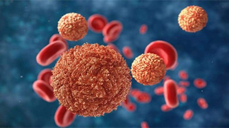 Zika Virus Case: कर्नाटक में सामने आया जीका वायरस का पहला मरीज, जानिए क्या है जीका वायरस के लक्षण और बचाव के उपाय