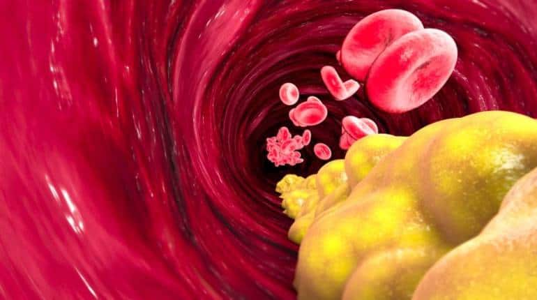 Bad cholesterol की दुश्मन हैं ये चीजें, अभी से अपनी डाइट में करें शामिल