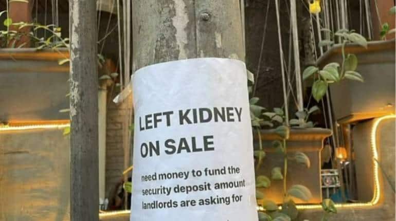 Kidney for Sale: iPhone के बाद अपार्टमेंट के लिए किडनी बिकाऊ, बेंगलुरु का यह पोस्टर तेजी से वायरल, समझें पूरा मामला