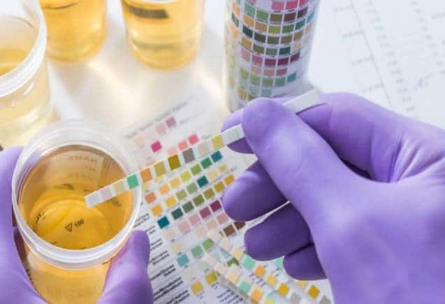 Diabetes: यूरिन से संकेत मिलता है शुगर की बीमारी है या नहीं, जानिए कैसे करें पहचान