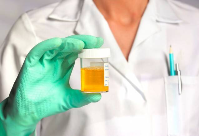 Urine Colour: पेशाब का रंग पीला क्यों होता है?  वैज्ञानिकों ने किया बड़ा खुलासा