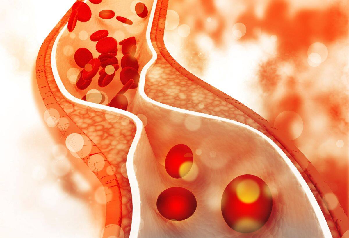 Bad Cholesterol : शरीर में जमे कोलेस्ट्रॉल को आउट कर देगा ये जूस, हाई ब्लड प्रेशर भी हो सकता है कंट्रोल Bad Cholesterol : शरीर में जमे कोलेस्ट्रॉल को आउट कर देगा ये जूस, हाई ब्लड प्रेशर भी हो सकता है कंट्रोल