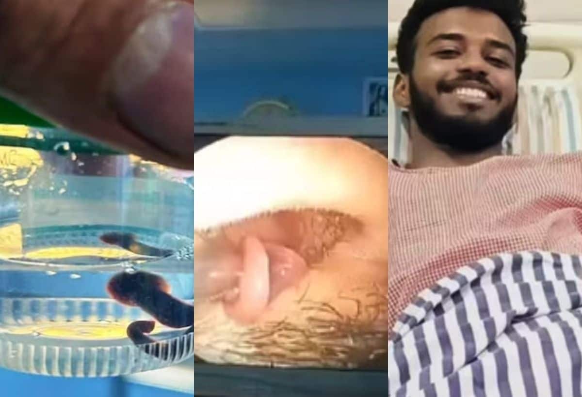 वाटरफॉल में नहाते समय शख्स की नाक में चली गई जोंक, 15 दिन तक चूसती रही खून, फिर डॉक्टरों ने जो किया, देखकर हर कोई हैरान वाटरफॉल में नहाते समय शख्स की नाक में चली गई जोंक, 15 दिन तक चूसती रही खून, फिर डॉक्टरों ने जो किया, देखकर हर कोई हैरान