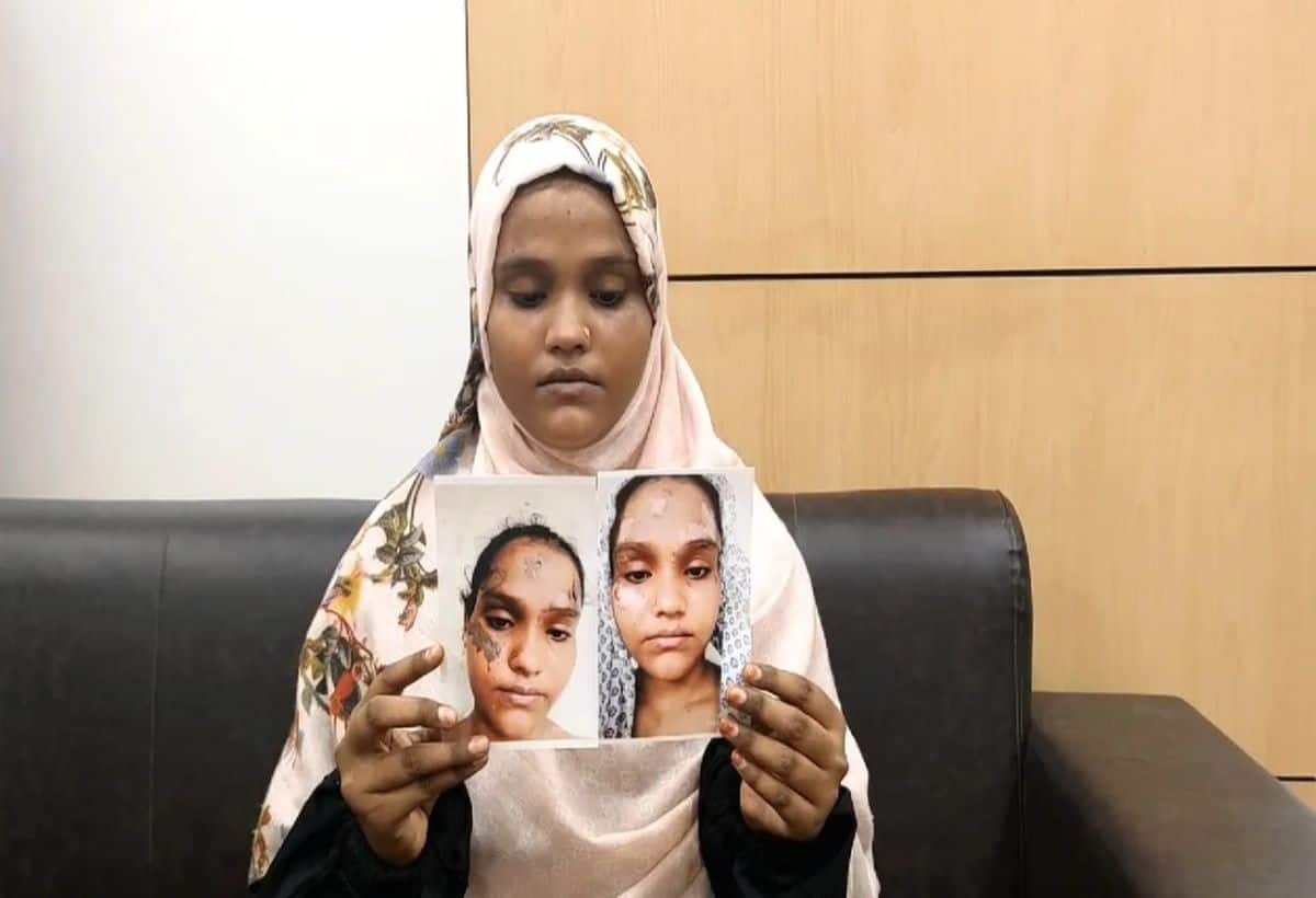 Ayodhya News: मुस्लिम महिला ने की PM मोदी-CM योगी की तारीफ, नाराज पति ने पहले जलाया चेहरा, फिर दिया तीन तलाक