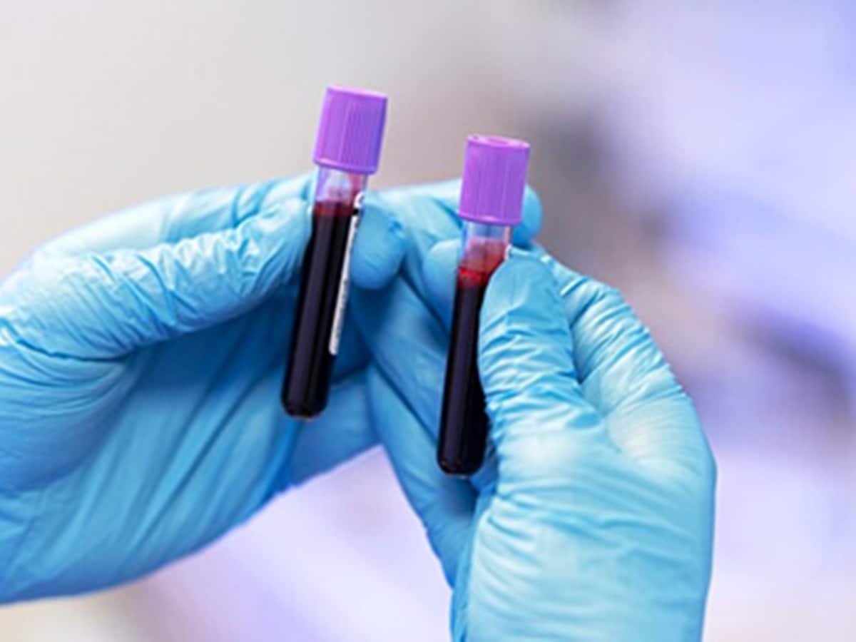 Suraksha Diagnostic IPO के लिस्टिंग की एक्सपर्ट स्ट्रैटेजी, ग्रे मार्केट से ये हैं संकेत