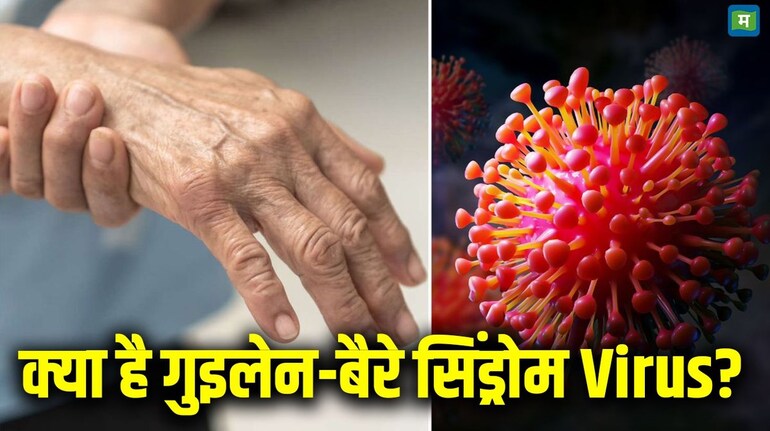 Guillain Barre Syndrome: पुणे में गुइलेन-बैरे सिंड्रोम से पहली मौत, 101 केस एक्टिव, GBS के 16 मरीज वेंटिलेटर पर, दुर्लभ वायरस के बारे में जानें सबकुछ