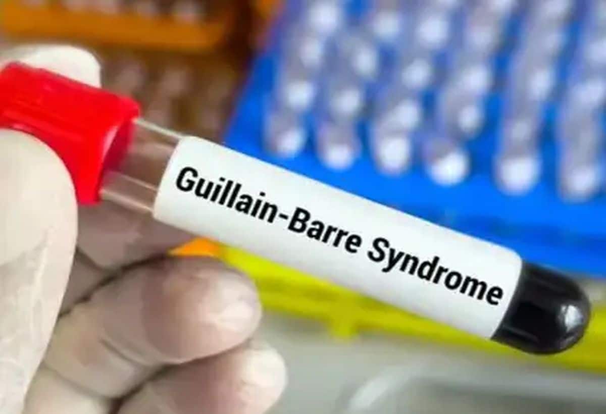 Guillain Barre Syndrome: आंध्र प्रदेश में GBS से महिला की मौत, अब तक 2 लोगों की गई जान Guillain Barre Syndrome: आंध्र प्रदेश में GBS से महिला की मौत, अब तक 2 लोगों की गई जान
