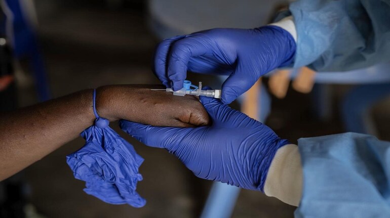 Congo Mysterious Disease: अफ्रीकी देश कांगो में फैली जानलेवा बीमारी, चमगादड़  से फैला वायरस, अचानक 50 लोगों की मौत - congo mysterious disease killed over  50 people in few hours world health