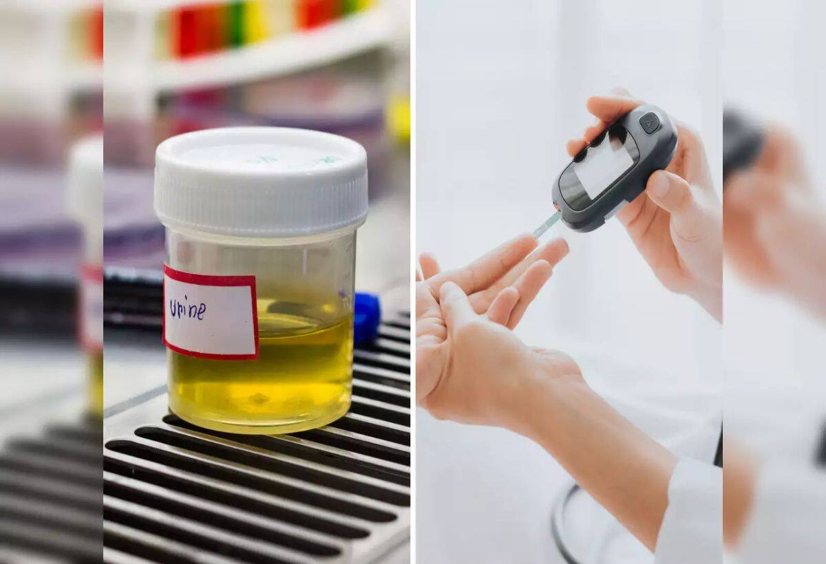 Diabetes Urine Symptoms: पेशाब में ही पता चल जाएगा डायबिटीज के शिकार हैं या नहीं, ऐसे लक्षण दिखने पर हो जाएं अलर्ट