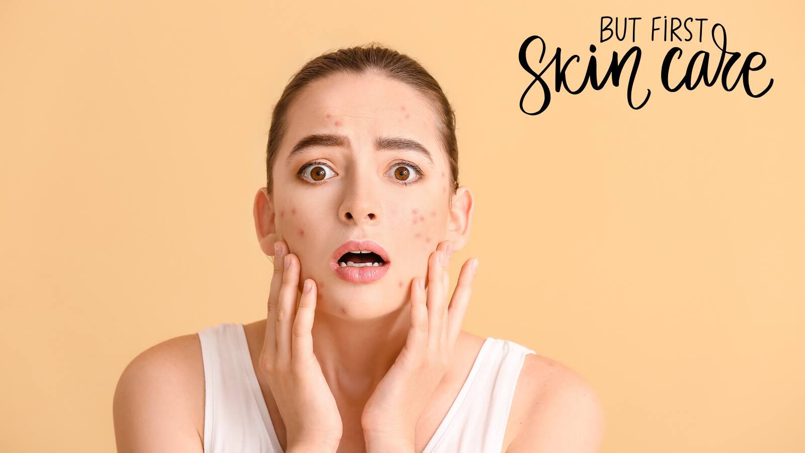 Summer Skin Care: गर्मी में मुंहासे से बचने के ये हैं खास उपाय, स्किन का ऐसे रखें ख्याल, चेहरे में आएगी चमक