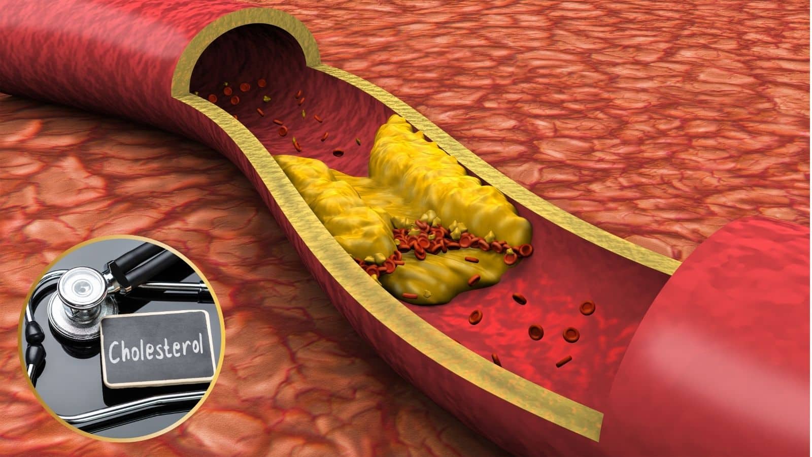 Cholesterol: नसों में जमा मोम जैसा कोलेस्ट्रॉल हटाने के लिए अपनाएं ये 5 घरेलू उपाय, एक्स्ट्रा कोलेस्ट्रॉल होगा जड़ से खत्म