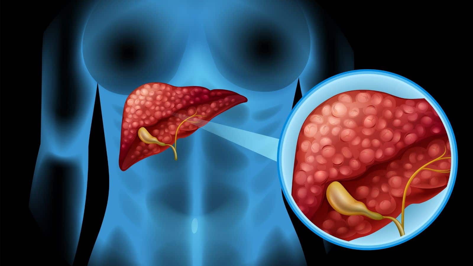 National-Liver: कहीं आप भी तो नहीं कर रहे हैं ये गलतियां? लिवर के लिए हो सकती है खतरनाक – #INA