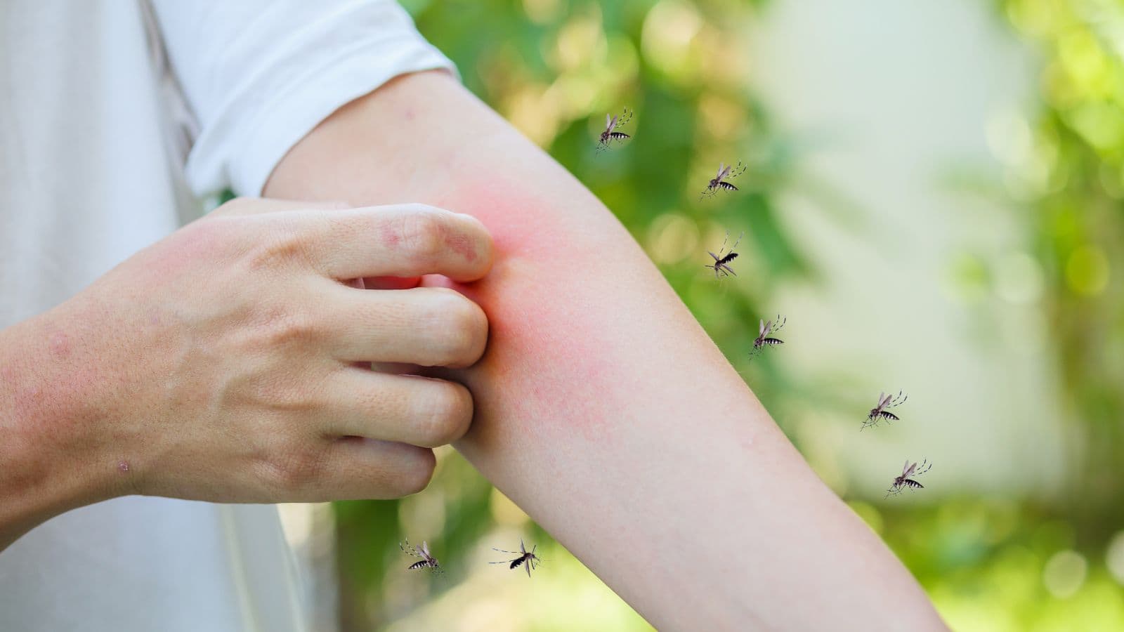 Mosquitoes: इन लोगों से दूर रहते हैं मच्छर! जानिए कौन-सा ब्लड ग्रुप है इनका सबसे बड़ा दुश्मन Mosquitoes: इन लोगों से दूर रहते हैं मच्छर! जानिए कौन-सा ब्लड ग्रुप है इनका सबसे बड़ा दुश्मन