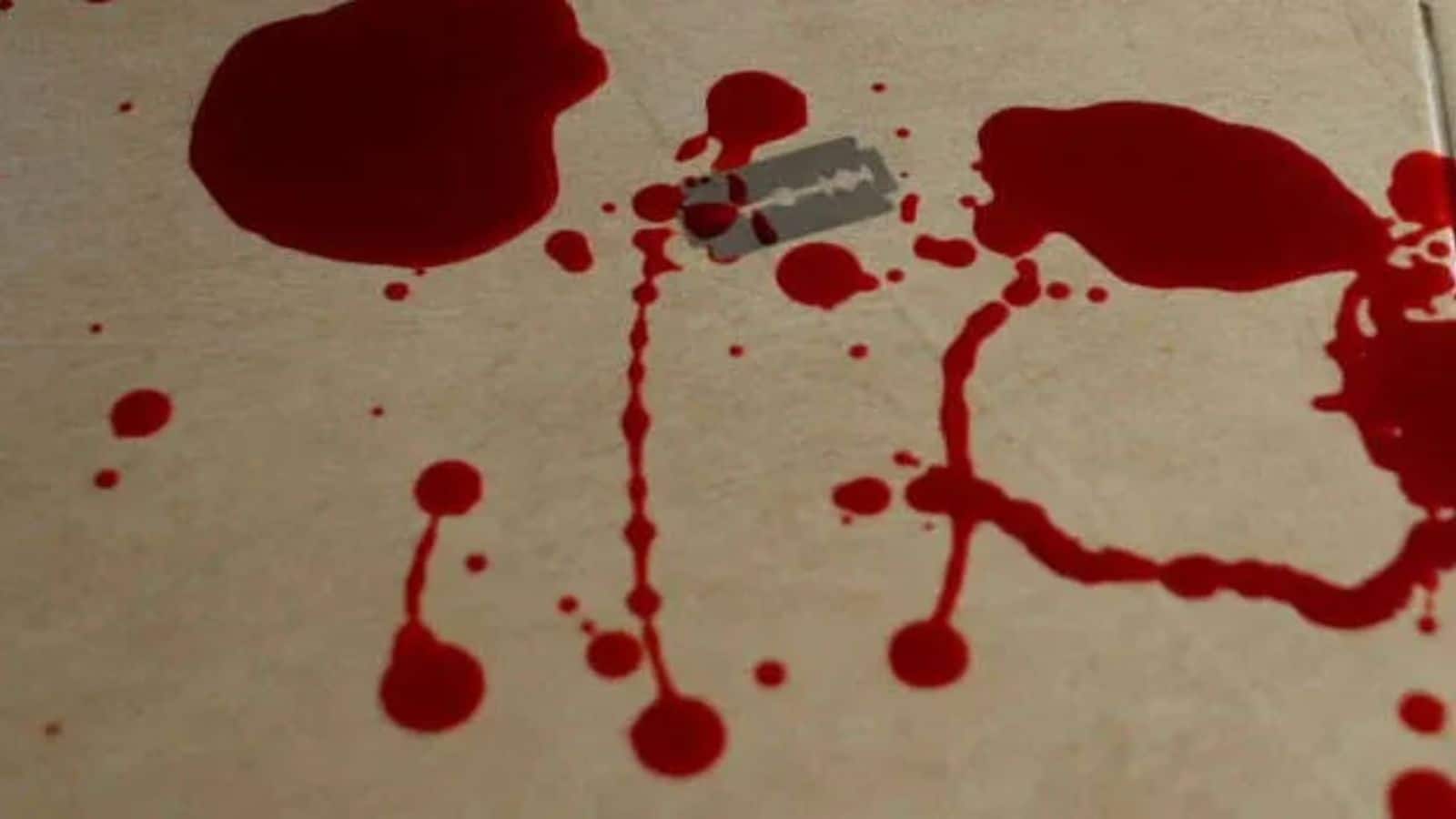 भतीजे ने ठुकराया प्यार, तो चाची ने थाने में काट ली कलाई!