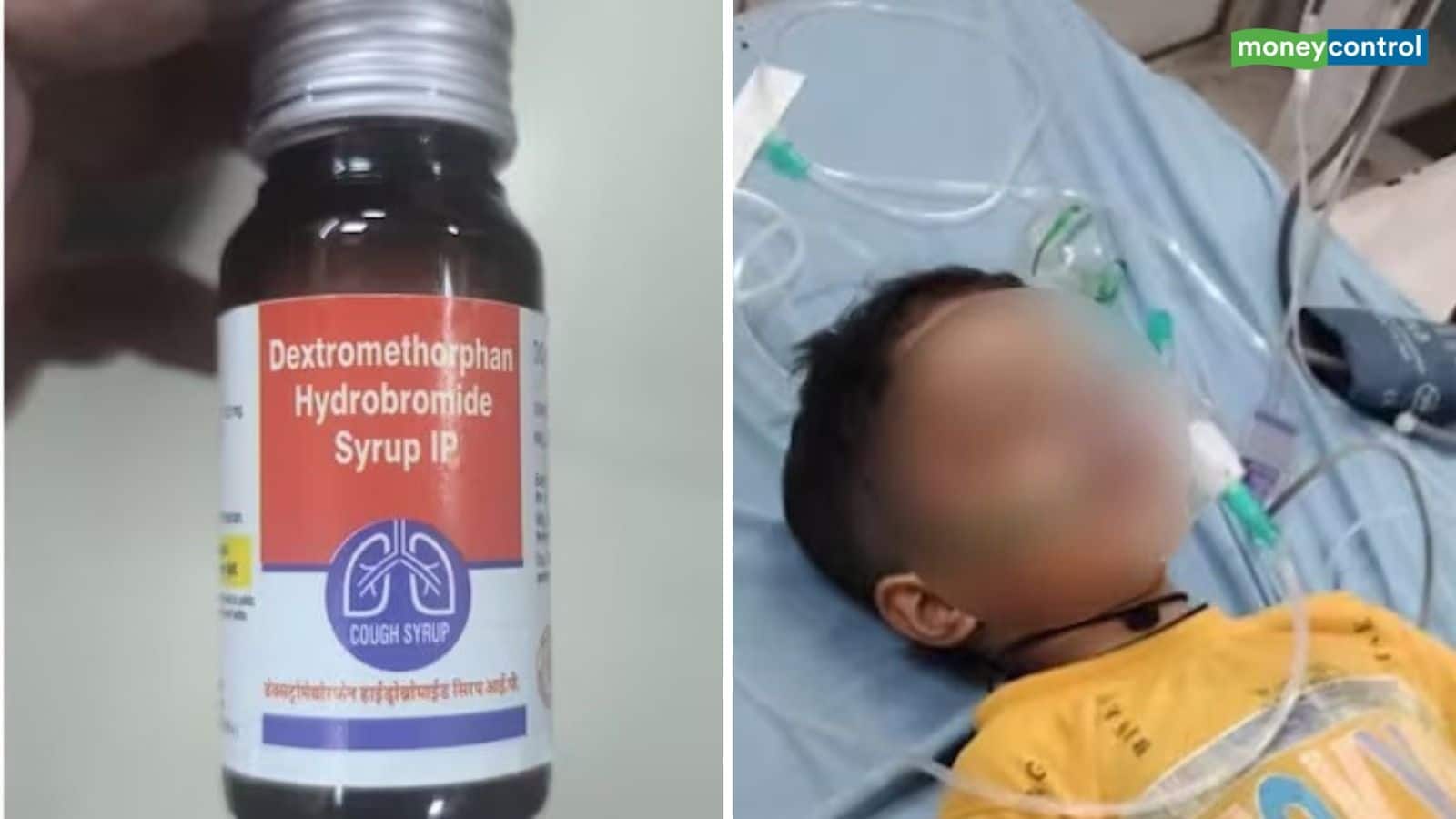 MP Cough Syrup Death: मध्य प्रदेश में कफ सिरप से बच्चों की किडनी फेल, 'जानलेवा' दवा से छिंदवाड़ा में 9 मासूमों की मौत