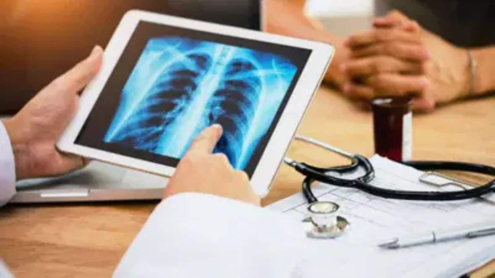 ICMR ने दी स्वदेशी टीबी किट को हरी झंडी, जांच होगी आसान
