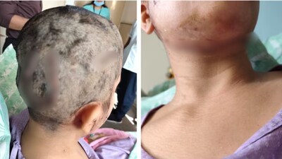 मॉर्निंग वॉक पर निकली महिला को पालतू कुत्ते ने बनाया शिकार!