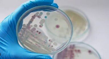 Bacteria: અમેરિકામાં 33 વર્ષની મહિલા ખતરનાક બેક્ટેરિયાનો બની શિકાર, ગુમાવ્યો પગ