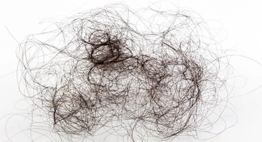 Hair Growth Problems: જો તમે તમારા વાળને સ્ટ્રોક કરતાની સાથે જ તમારા હાથમાં ગુચ્છો આવી જાય, તો આ રીતે નાળિયેર તેલ લગાવવાનું શરૂ કરો, વાળ ખરતા થશે બંધ