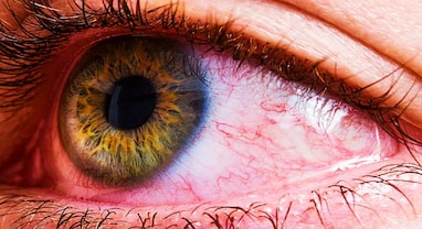 Diabetes symptoms: આ ડાયાબિટીસનું સૌથી કોમન લક્ષણ, દેખાય કે તરત જ ડૉક્ટરનો કરો સંપર્ક