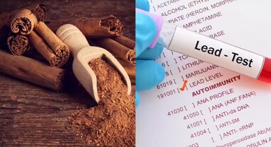 FDA Warning: તજ છે 'ધીમું ઝેર'? FDA એ આપી ચેતવણી, 11 ટોપની બ્રાન્ડ્સને કરી રિકોલ- જોઈ લો સંપૂર્ણ લિસ્ટ