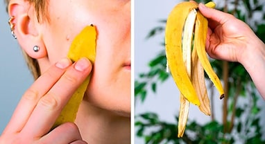 Banana Peels For Face: ફેંકી દેવા માટે નથી કેળાની છાલ ! છાલને ચહેરા પર લગાવો અને 7 દિવસમાં ફરક અનુભવો