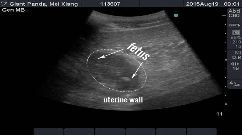 The stamp-sized devices can also monitor the development of foetuses in the womb. (Representative image)