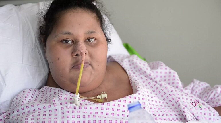 Egyptian National Known As Worlds Heaviest Woman Dies In Uae 