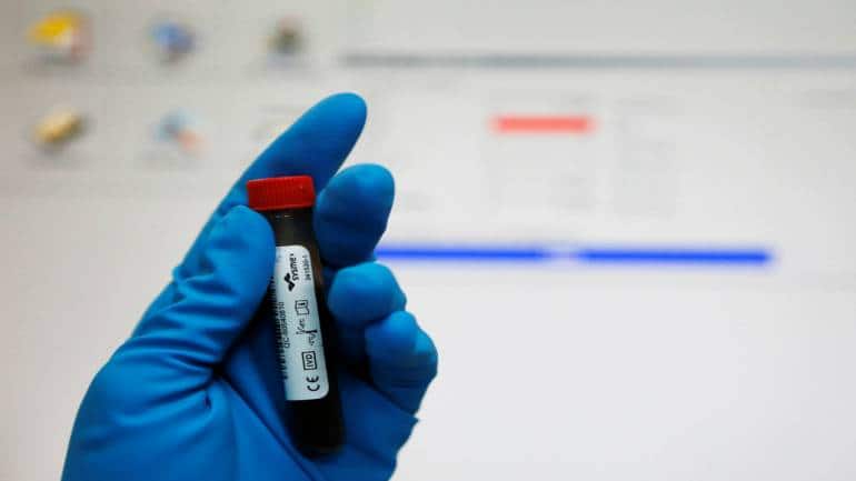 Coronavirus Pandemic Blood Group O Less Susceptible To Covid 19