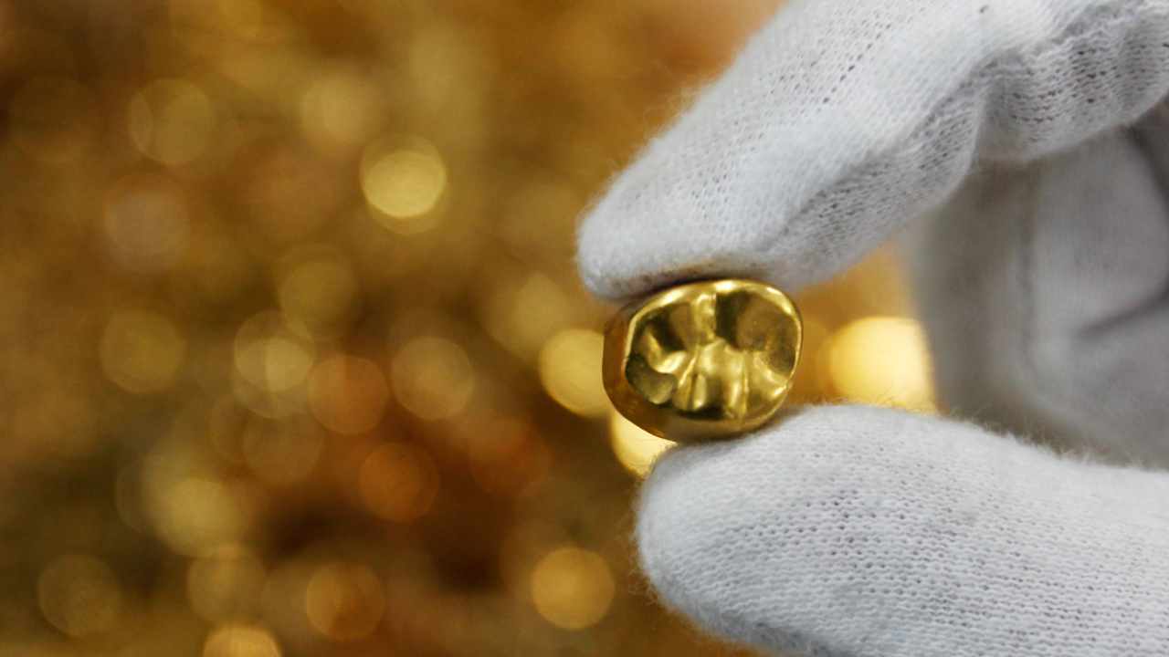 3. Full set of 18K gold teeth | Did this person have a scuffle with the driver? One "pow" and the entire set was out. The poor fella, must have run like hell. (Image: Reuters) 3. Full set of 18K gold teeth | Did this person have a scuffle with the driver? One "pow" and the entire set was out. The poor fella, must have run like hell. (Image: Reuters)