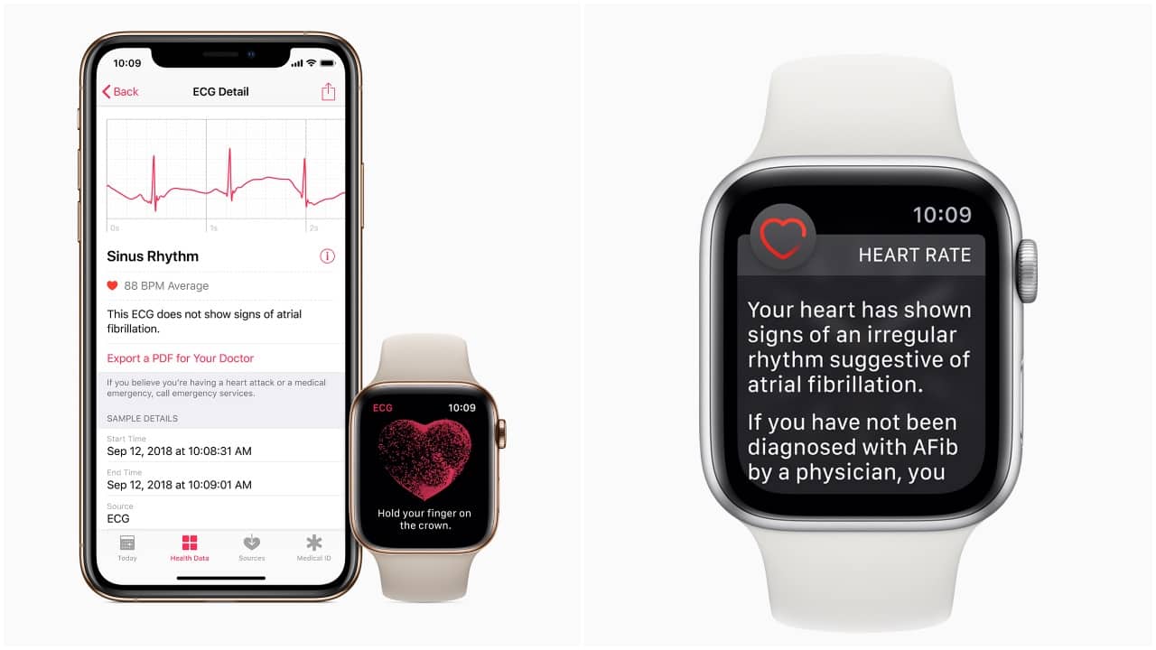 Electrocardiogramme best sale apple watch