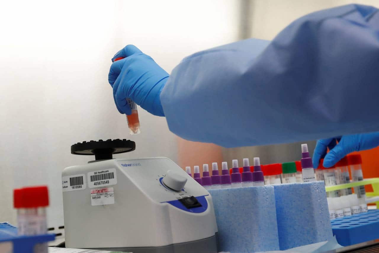 Why RT-PCR COVID-19 test can be cheaper than the Rs 4,500 ICMR price cap