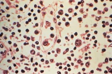 Explained | What is Hantavirus? Is it as deadly as Coronavirus? Explained | What is Hantavirus? Is it as deadly as Coronavirus?