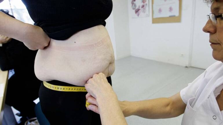 World Obesity Day: Waist Size and Obesity