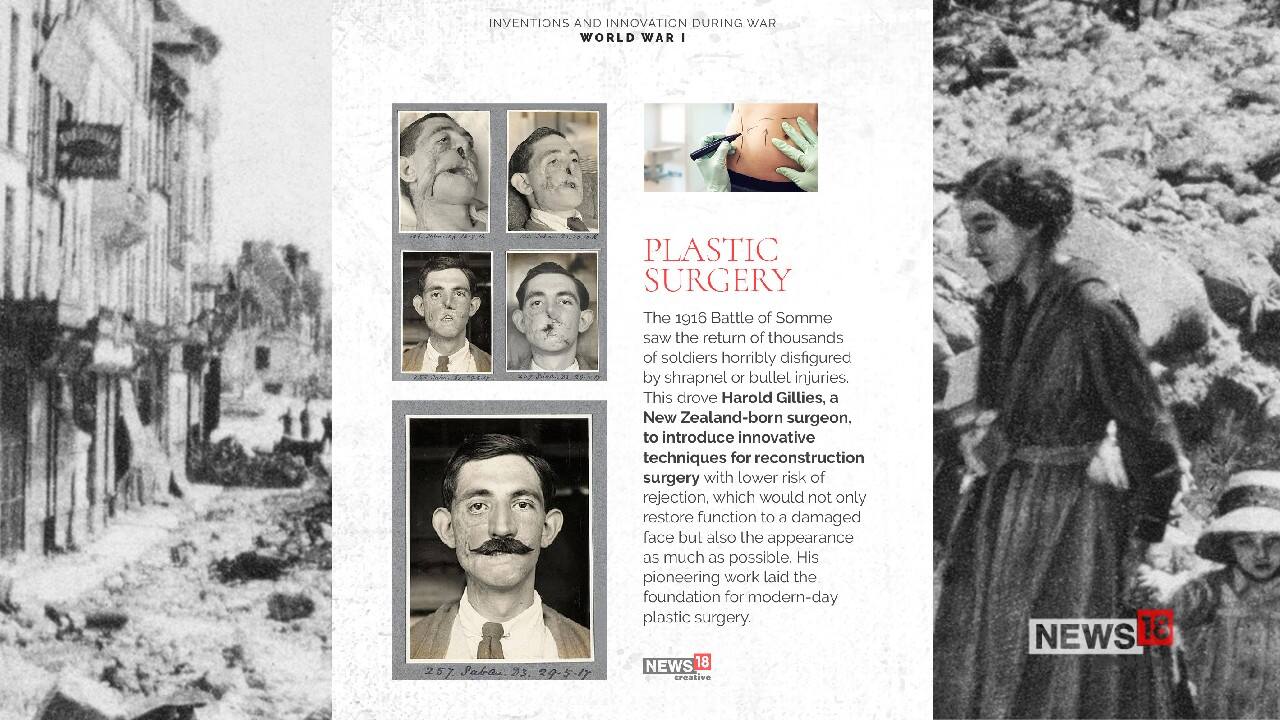 Plastic surgery (Image: News18 Creative)