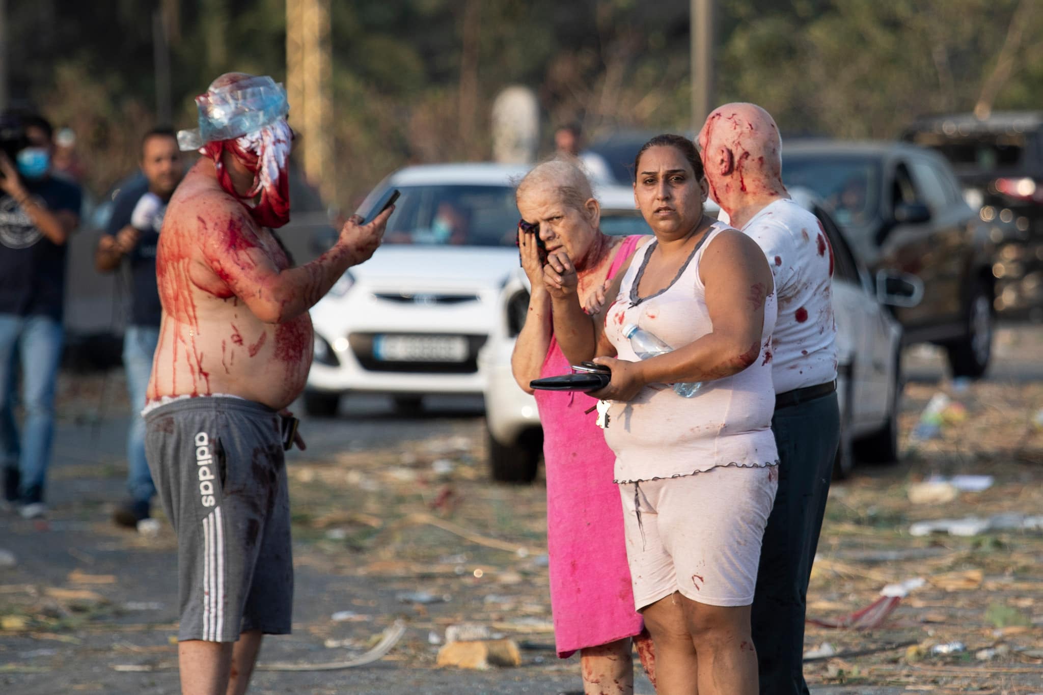 Injured people stand after a massive explosion in Beirut, Lebanon, Tuesday, Aug. 4, 2020. (AP Photo/Hassan Ammar)