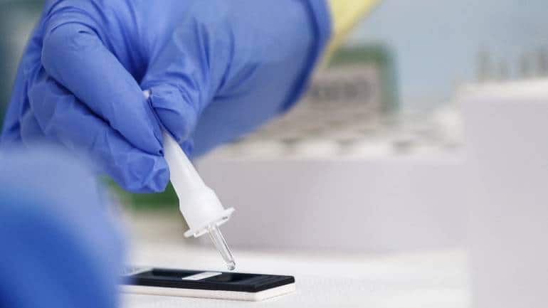 WHO, partners roll out COVID-19 test that promises result 'in minutes' - Moneycontrol
