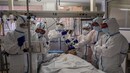 Stroke patients with COVID-19 show unexpected high mortality: Study