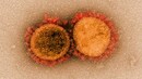 Health Ministry to hold meeting of Joint Monitoring Group today to discuss new coronavirus strain