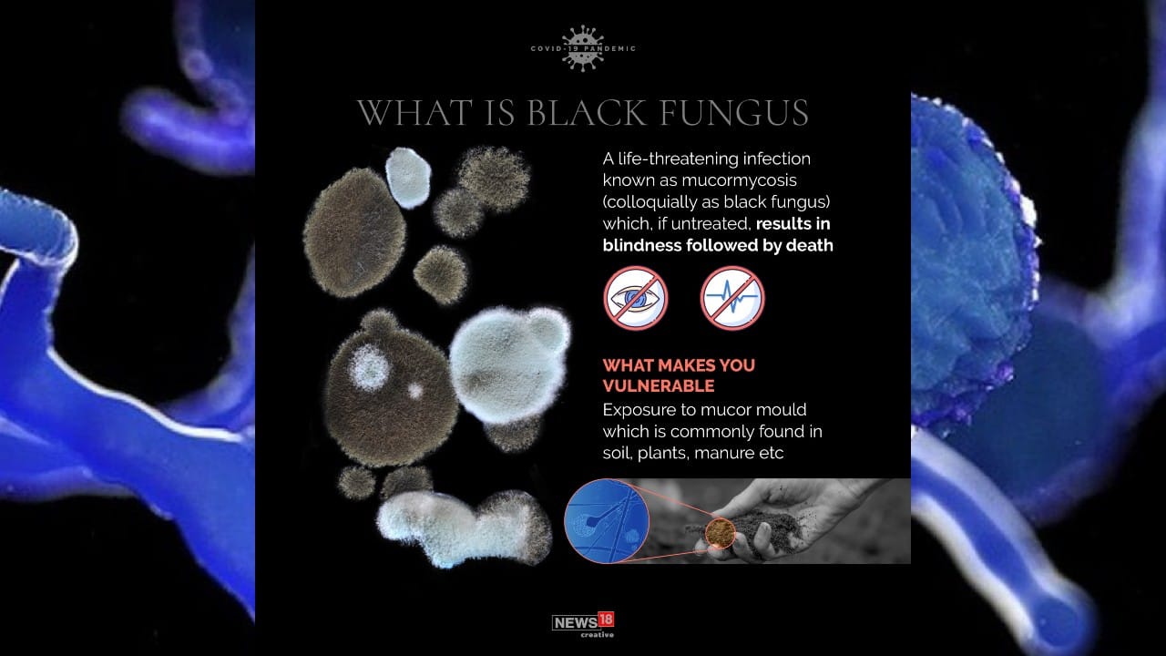 A life-threatening infection known as mucormycosis (colloquially as black fungus) which, if untreated, results in blindness followed by death. (Image: News18 Creative)