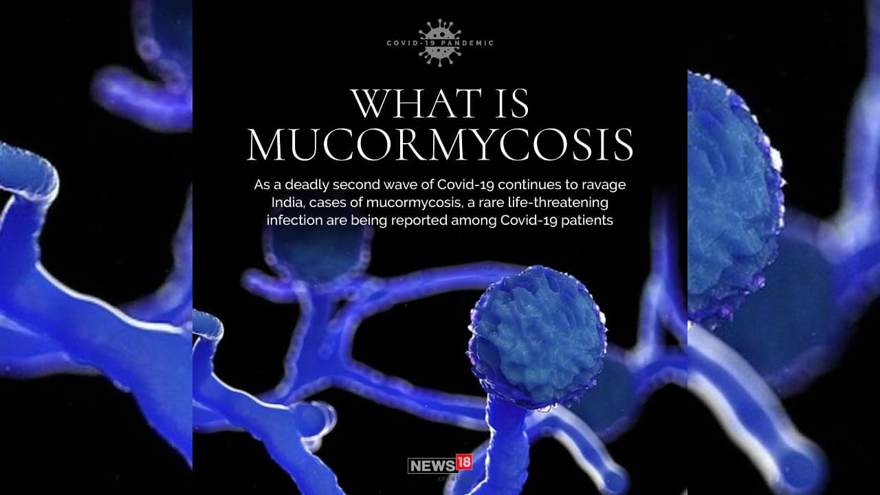 As a deadly second wave of COVID-19 continues to ravage India, cases of mucormycosis, a rare life-threatening infection are being reported among COVID-19 patients. (Image: News18 Creative)
