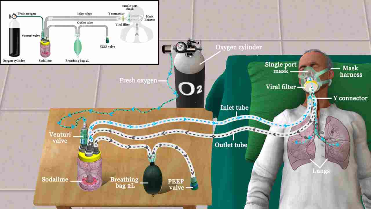 Amid the rising demand for medical oxygen due to increasing COVID-19 cases in India, the team has designed the prototype of a breathing device called ‘reBreather’. (Image: github.com/TCTD-IIT-Bombay/reBreather)