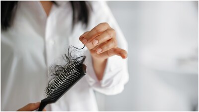 Winter can trigger hair fall due to dryness and cold air. Experts share causes and tips to reduce hair loss and strengthen strands naturally. 