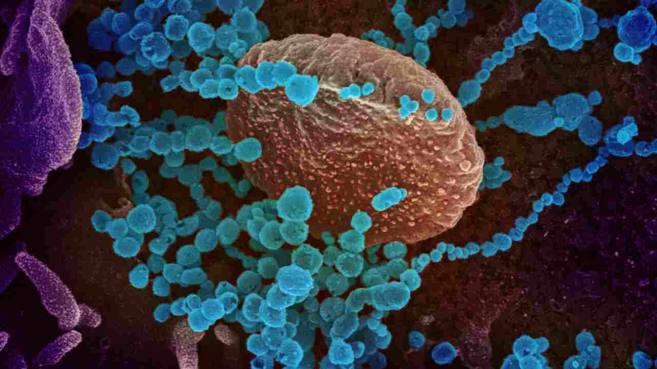MSF asks Regeneron to make COVID antibody cocktail affordable; forego patent claims MSF asks Regeneron to make COVID antibody cocktail affordable; forego patent claims