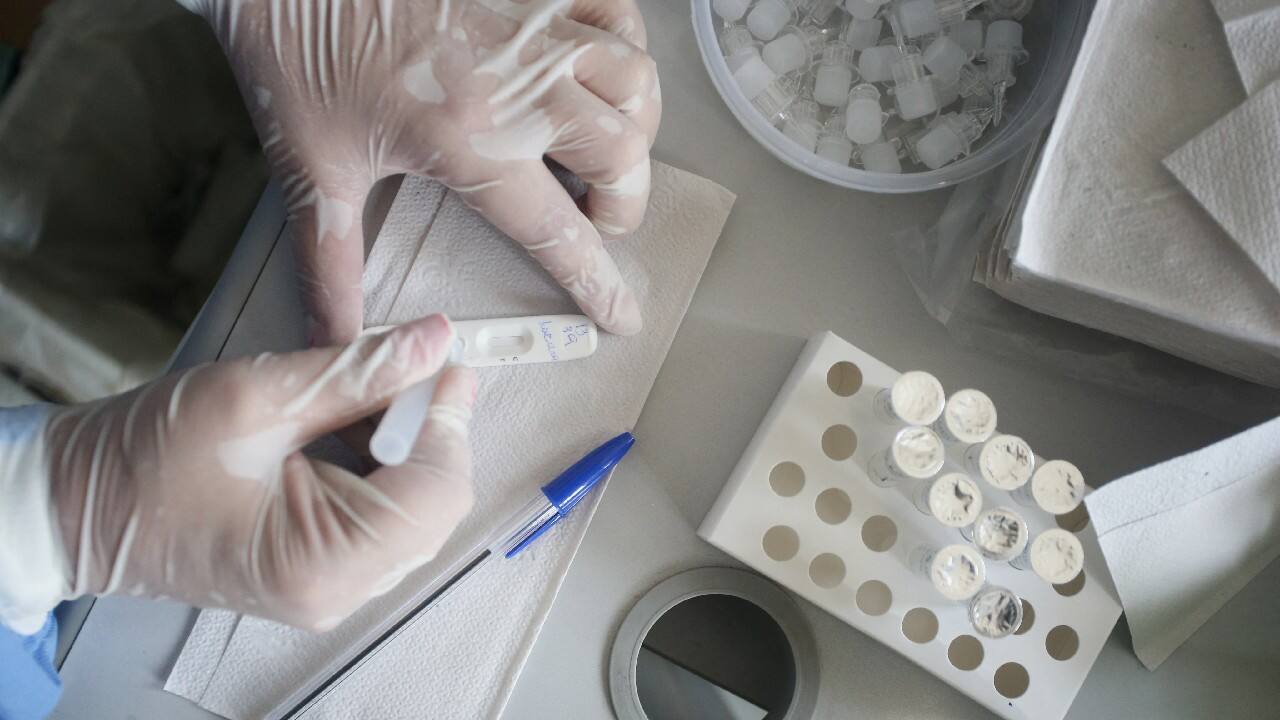 Daily COVID-19 cases in India lowest in 662 days