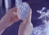 Surge in childhood tuberculosis cases in Europe sparks public health concerns
