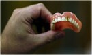 UK man gets dentures back 11 years after losing it in Spain